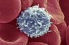 Tutkijat ovat löytäneet tavan, joka aiheuttaa T-solujen alkaa taistella syöpää