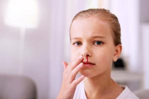 Kuinka pysäyttää lapsen nenäverenvuoto: lastenlääkärin neuvot