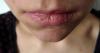 Miten helppoa parannuskeinoa huulten