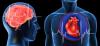 Sydäninfarktin ja aivohalvauksen: 7 suuria virheitä, että ne herättävät